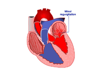 2018年美国心脏病学会年会（ACC2018）