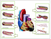 2019心脏协会科学年会（AHA2019）