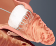 第40届美国心律学会科学年会（HRS 2019）