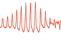 2020美国心脏协会科学年会（AHA 2020）