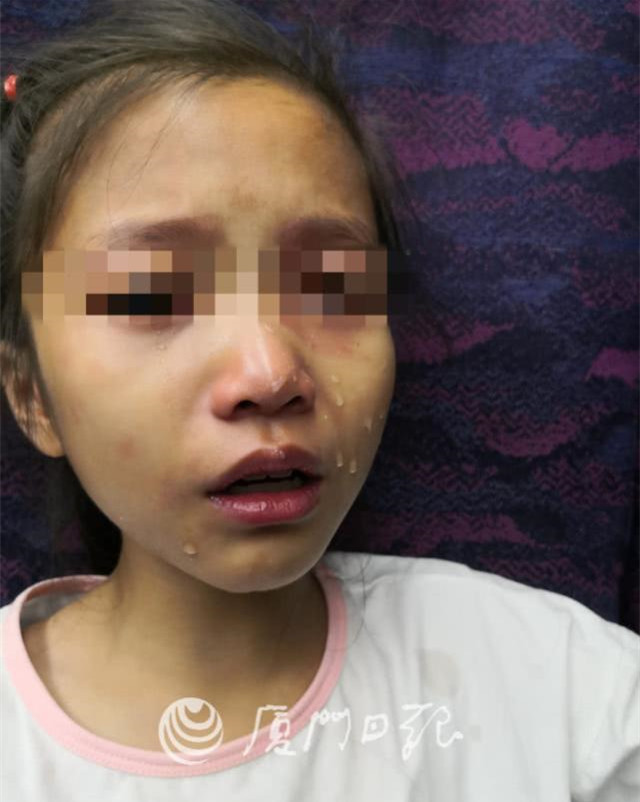 8岁女童动车上烫伤,眼科医生出手相救:"我曾是军人" | 医脉3分钟