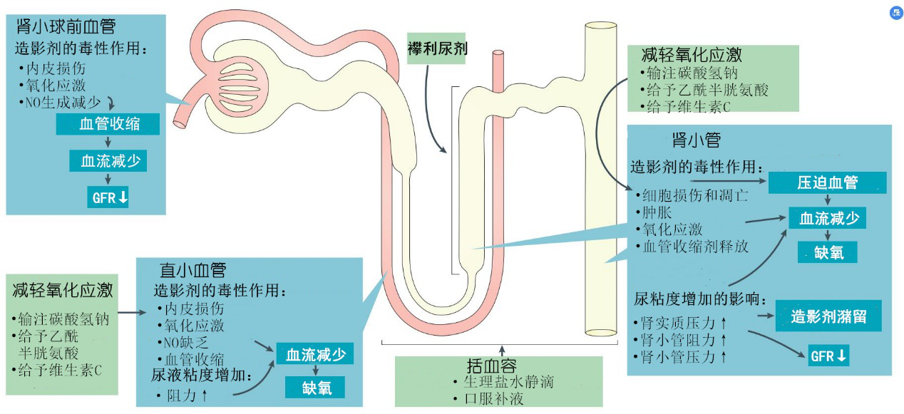 不可小觑的造影剂肾病:图解ci-aki