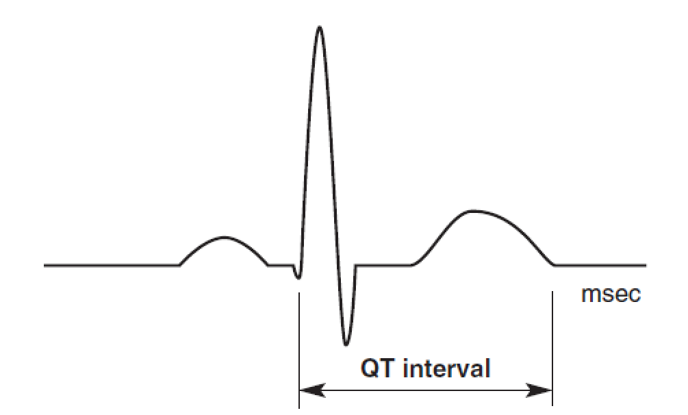 心电图qtc图片