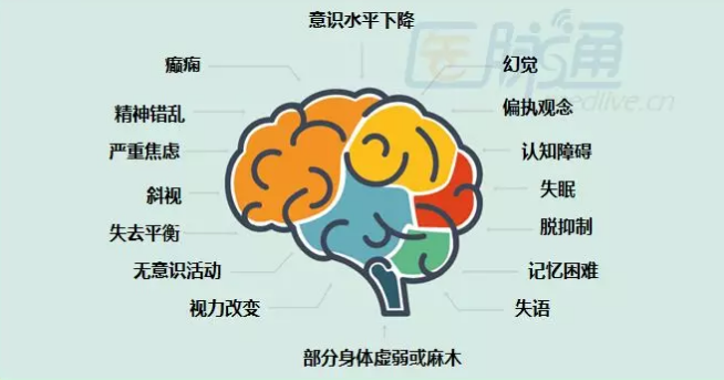 自身免疫性脑炎都有哪些症状?